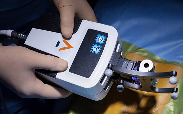 Accelus and CHP Call Off Minimally Invasive Spinal Surgery SPAC Merger