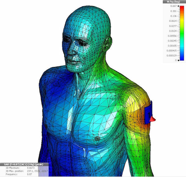 Wearable Medical Devices Present Engineering Challenges