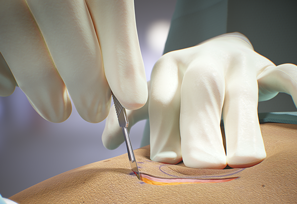 FundamentalVR Simulates Soft Tissue With Haptics for Medical Education