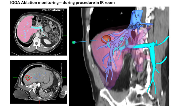 EDDA Technology Raises $150M to Develop Robotics for Precision Surgery