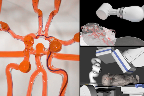 MIT Team Develops Teleoperated Robot to Treat Endovascular Patients Within Stroke’s ‘Golden Hour’