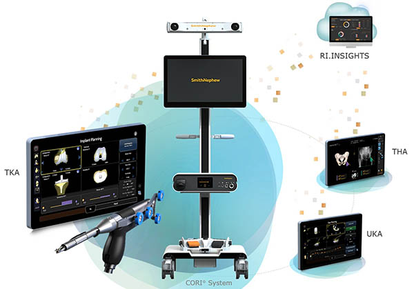 Smith+Nephew Launches CORI, ‘Turnkey’ System for Robot-Assisted Orthopedic Surgery