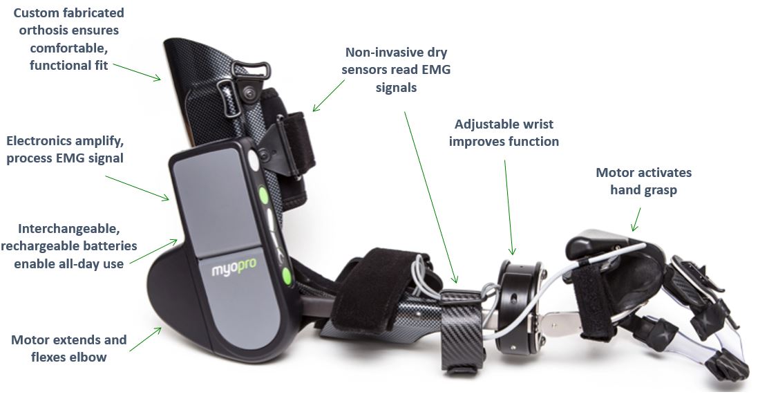 Myomo Device Passes First Phase of Brain-Computer Interface Clinical Trial